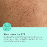 Απολέπιση Σώματος Glycolic Body Scrub 250g - Απολεπιστικό Σώματος με Γλυκολικό Frank Body