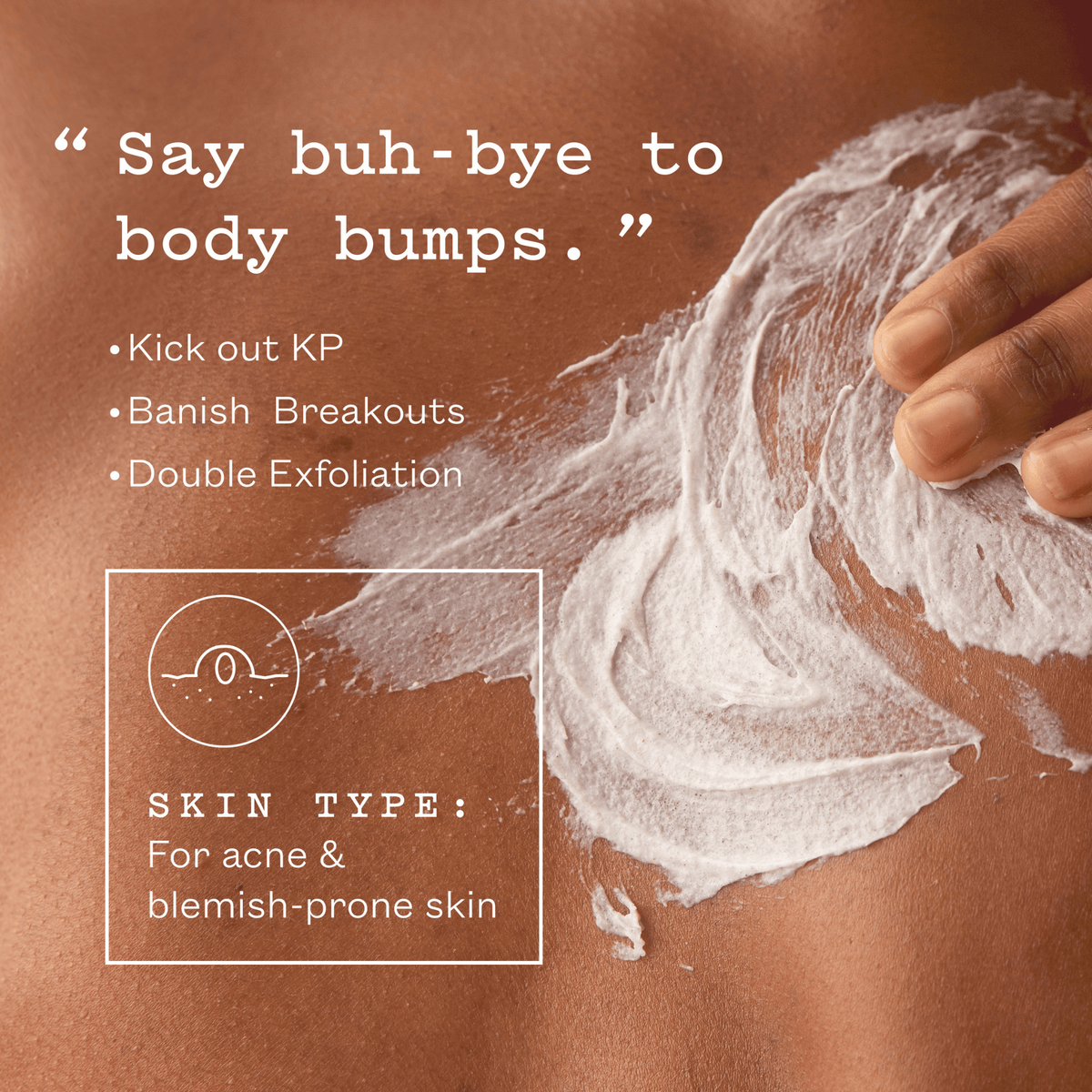 Απολέπιση Σώματος Glycolic Body Scrub 250g - Απολεπιστικό Σώματος με Γλυκολικό Frank Body