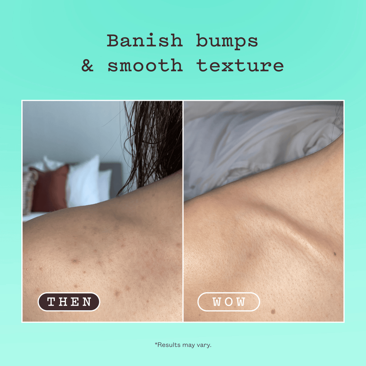 Απολέπιση Σώματος Glycolic Body Scrub 250g - Απολεπιστικό Σώματος με Γλυκολικό Frank Body