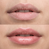 Περιποίηση Χειλιών Lip Peeling 15ml - Απαλό Gel Απολέπισης Χειλιών με AHA & BHA Trew