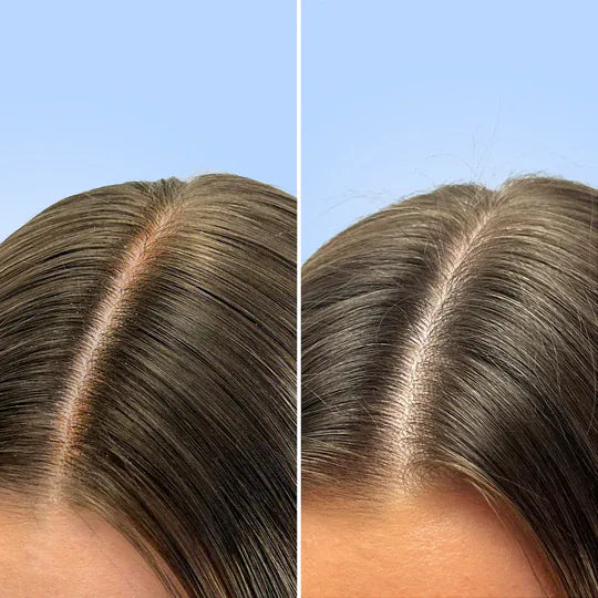 Σαμπουάν Σετ για Βαθύ Καθαρισμό - Haircare Clarifying Duo Q+A Natural Skincare